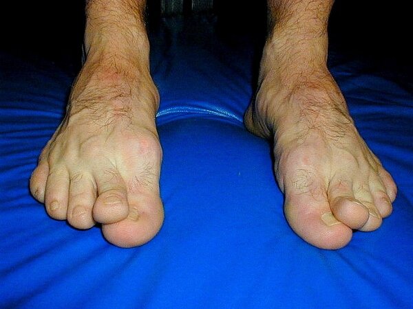 Footguys show meaty feet at Foot Friends NYC event