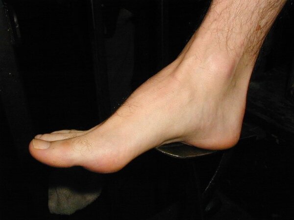 Tommi balances Alan Pratt with his size 14 feet
