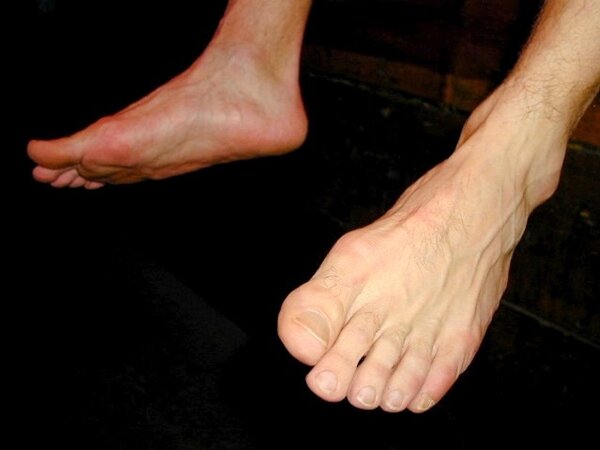 Tommi balances Alan Pratt with his size 14 feet